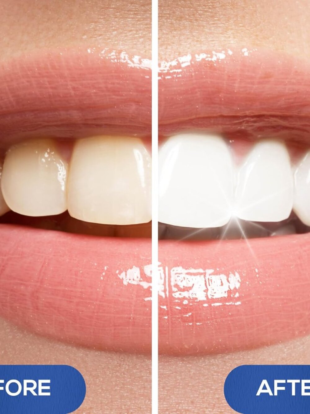 Pack of 4 Venus Visage Teeth Whitening Pen Professional Whitening Gel 30+ Uses - Picture 5 of 5